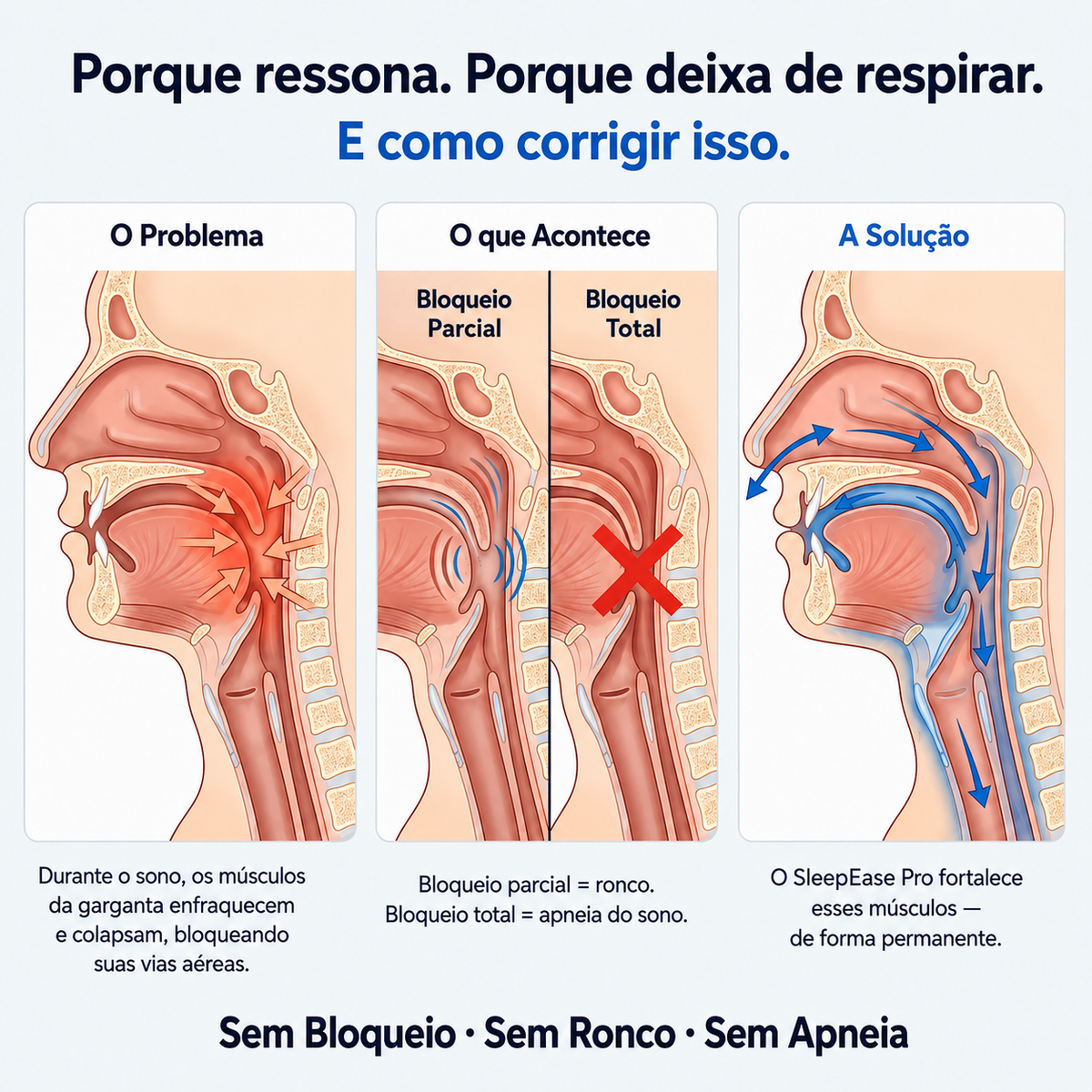 Dispositivo Antirronco
