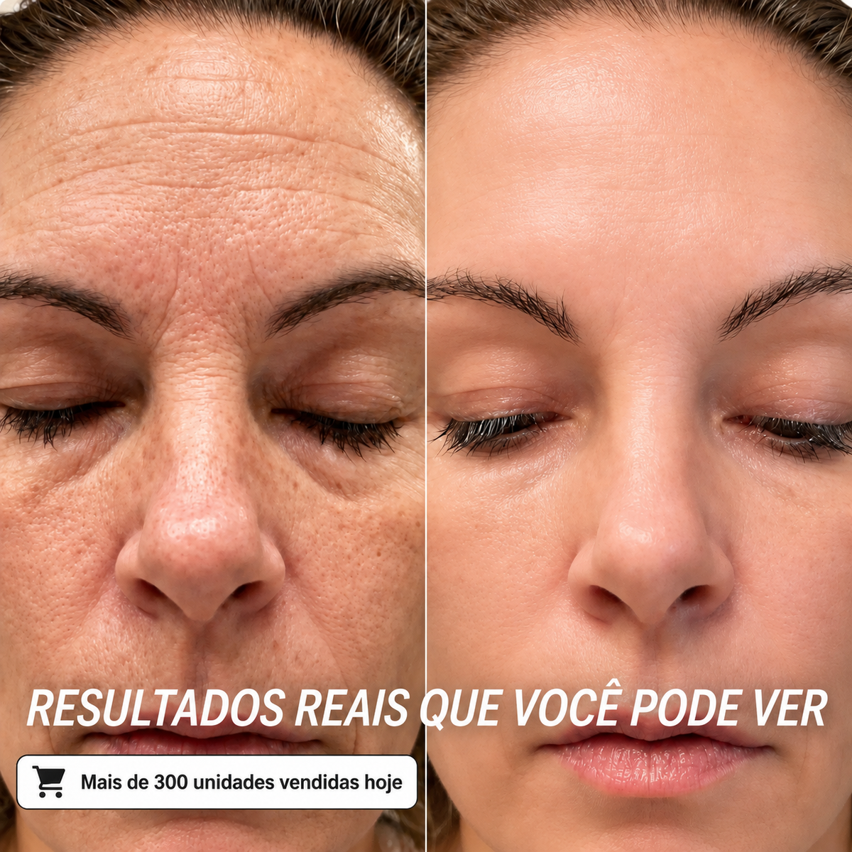 Bálsamo Multiusos de Colagénio Coreano para Volume